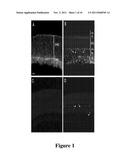 HDAC4, HDAC5, HDAC6, HDAC7, AND HIF1 ALPHA MODULATION OF RETINAL CELL     SURVIVAL diagram and image