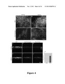 HDAC4, HDAC5, HDAC6, HDAC7, AND HIF1 ALPHA MODULATION OF RETINAL CELL     SURVIVAL diagram and image