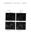 CCR3 Inhibition for Ocular Angiogenesis and Macular Degeneration diagram and image