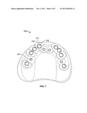 Method For Pre-Operative Visualization Of Instrumentation Used With A     Surgical Guide For Dental Implant Placement diagram and image