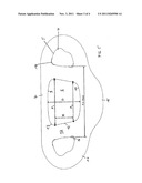 TOOTHED CHAIN, IN PARTICULAR FOR A VEHICLE DRIVE diagram and image