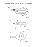 SYSTEMS AND METHODS FOR PPG SENSORS INCORPORATING EKG SENSORS diagram and image