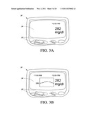 SYSTEMS AND METHODS FOR REPLACING SIGNAL ARTIFACTS IN A GLUCOSE SENSOR     DATA STREAM diagram and image