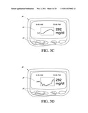 SYSTEMS AND METHODS FOR REPLACING SIGNAL ARTIFACTS IN A GLUCOSE SENSOR     DATA STREAM diagram and image