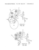 MINIMALLY INVASIVE DETERMINATION OF COLLATERAL VENTILATION IN LUNGS diagram and image