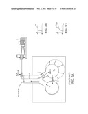 MINIMALLY INVASIVE DETERMINATION OF COLLATERAL VENTILATION IN LUNGS diagram and image