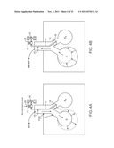 MINIMALLY INVASIVE DETERMINATION OF COLLATERAL VENTILATION IN LUNGS diagram and image