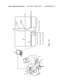 MINIMALLY INVASIVE DETERMINATION OF COLLATERAL VENTILATION IN LUNGS diagram and image