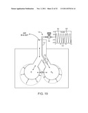 MINIMALLY INVASIVE DETERMINATION OF COLLATERAL VENTILATION IN LUNGS diagram and image