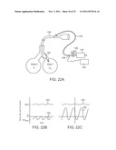 MINIMALLY INVASIVE DETERMINATION OF COLLATERAL VENTILATION IN LUNGS diagram and image