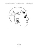 REMOTE CONTINUOUS SEIZURE MONITOR AND ALARM diagram and image