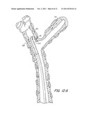 Pressure/Vacuum Actuated Catheter Forceps diagram and image