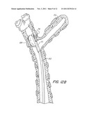 Pressure/Vacuum Actuated Catheter Forceps diagram and image