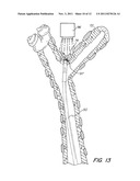 Pressure/Vacuum Actuated Catheter Forceps diagram and image
