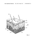 METHOD AND SYSTEM FOR TREATING SKIN TISSUE diagram and image