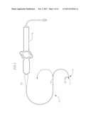 IRRIGATED ABLATION CATHETER WITH IMPROVED FLUID FLOW diagram and image