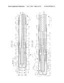 IRRIGATED ABLATION CATHETER WITH IMPROVED FLUID FLOW diagram and image