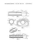 PRECISION ABLATING METHOD diagram and image