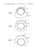 PRECISION ABLATING METHOD diagram and image