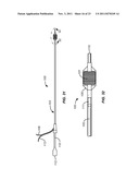 PRECISION ABLATING METHOD diagram and image