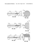 PRECISION ABLATING METHOD diagram and image