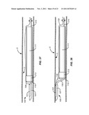 PRECISION ABLATING METHOD diagram and image