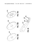 ORTHOPEDIC CAST REMOVER diagram and image