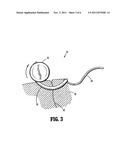 Articulating Axial Needle Grasper diagram and image