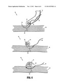 Articulating Axial Needle Grasper diagram and image