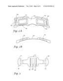 TOURNIQUET SYSTEM diagram and image