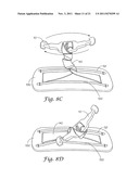 TOURNIQUET SYSTEM diagram and image