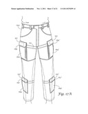 TOURNIQUET SYSTEM diagram and image