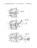 DEVICE AND METHOD FOR RESILIENTLY LOCKING A SCREW TO A PLATE diagram and image