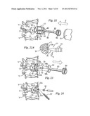 DEVICE AND METHOD FOR RESILIENTLY LOCKING A SCREW TO A PLATE diagram and image