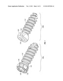 Locking Bone Screws and Methods of Use Thereof diagram and image