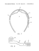 Visual Prosthesis diagram and image