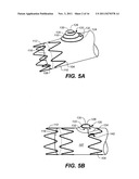 Mobile External Coupling with Internal Sealing Cuff for Branch Vessel     Connection diagram and image