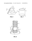 Mobile External Coupling with Internal Sealing Cuff for Branch Vessel     Connection diagram and image