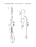 Mobile External Coupling with Internal Sealing Cuff for Branch Vessel     Connection diagram and image