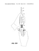 Mobile External Coupling with Internal Sealing Cuff for Branch Vessel     Connection diagram and image