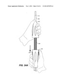 Mobile External Coupling with Internal Sealing Cuff for Branch Vessel     Connection diagram and image