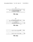 Drug Delivery After Biodegradation Of The Stent Scaffolding diagram and image