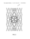 STENT WITH SELF-DEPLOYABLE PORTION HAVING WINGS OF DIFFERENT LENGTHS diagram and image