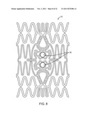STENT WITH SELF-DEPLOYABLE PORTION HAVING WINGS OF DIFFERENT LENGTHS diagram and image