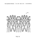 STENT WITH SELF-DEPLOYABLE PORTION HAVING WINGS OF DIFFERENT LENGTHS diagram and image