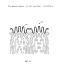 STENT WITH SELF-DEPLOYABLE PORTION HAVING WINGS OF DIFFERENT LENGTHS diagram and image