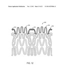 STENT WITH SELF-DEPLOYABLE PORTION HAVING WINGS OF DIFFERENT LENGTHS diagram and image