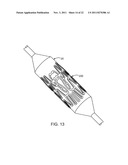 STENT WITH SELF-DEPLOYABLE PORTION HAVING WINGS OF DIFFERENT LENGTHS diagram and image