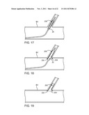 STENT WITH SELF-DEPLOYABLE PORTION HAVING WINGS OF DIFFERENT LENGTHS diagram and image