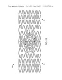 STENT WITH SELF-DEPLOYABLE PORTION HAVING WINGS OF DIFFERENT LENGTHS diagram and image